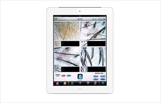 使用機器便可以檢閱,搜尋將有效改善顧客頭皮狀況之有效的病例數據。