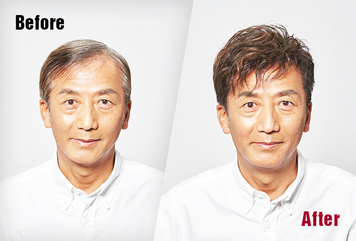 連毛孔都能真實呈現,自然的髮際線